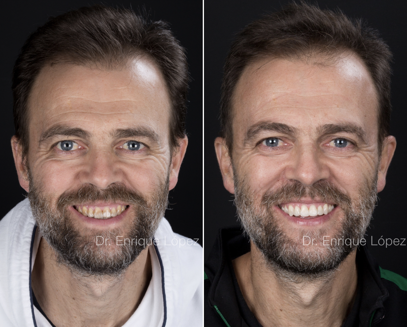 Foto comparativa 2