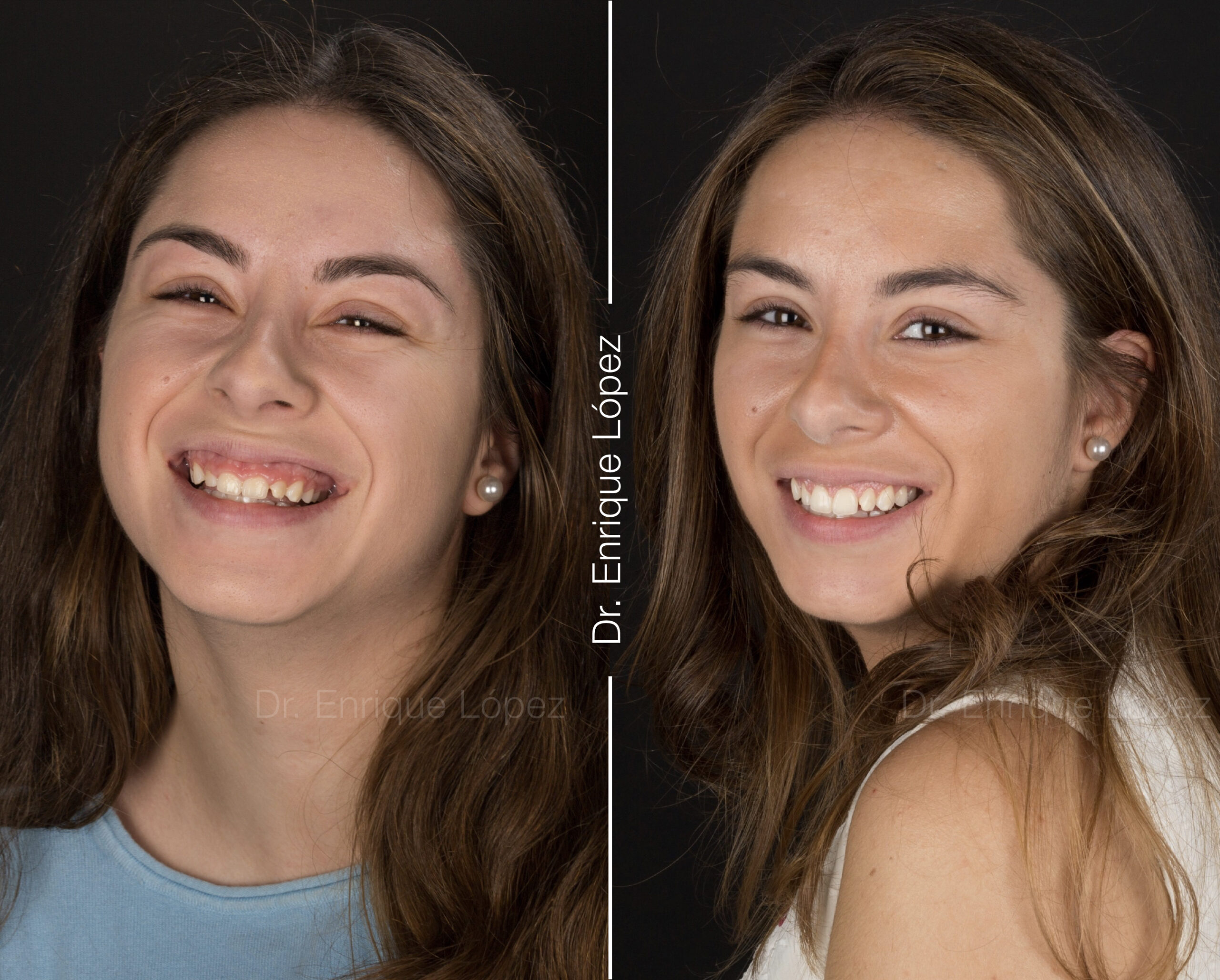 Foto comparativa 2