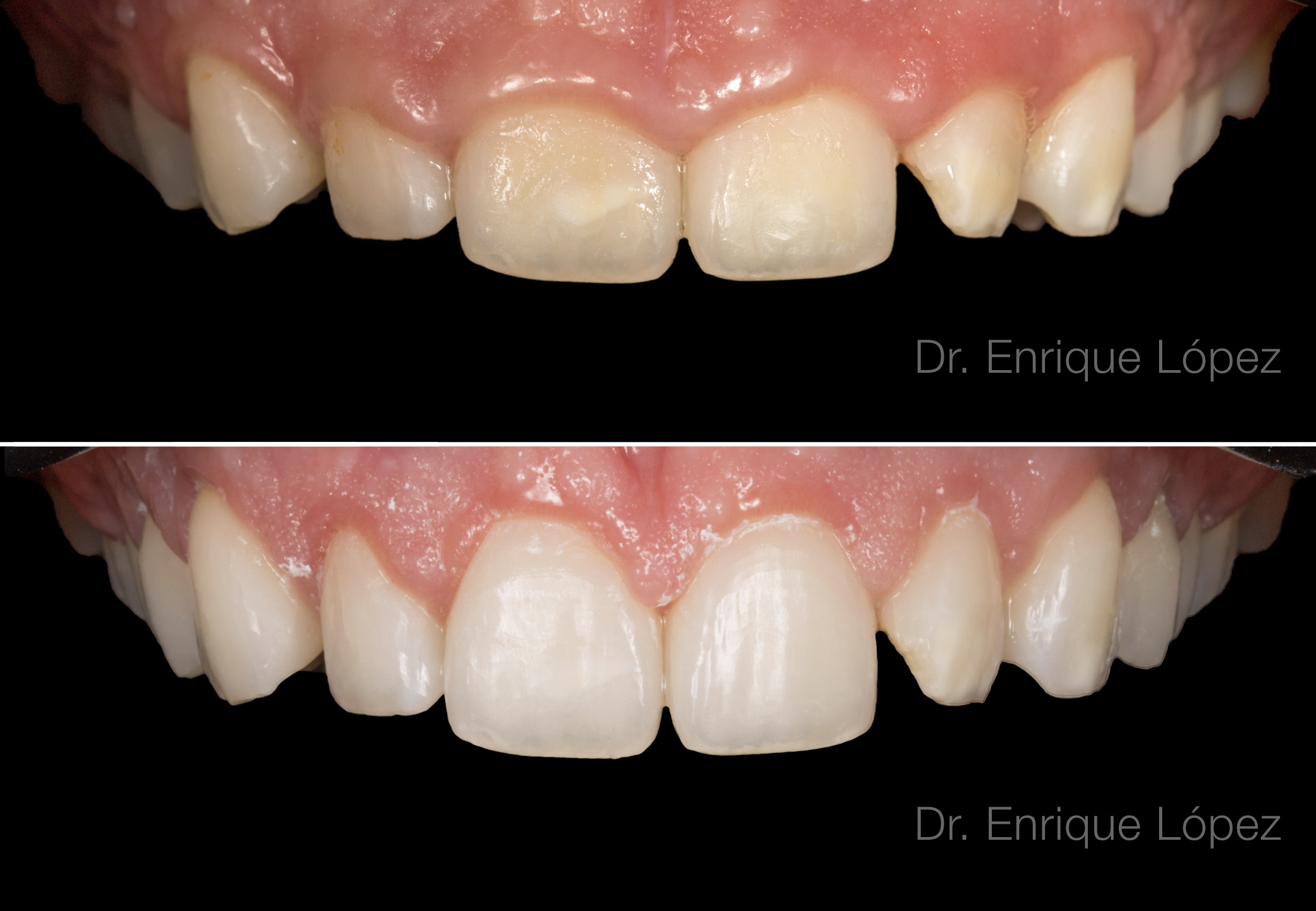 Foto comparativa 3