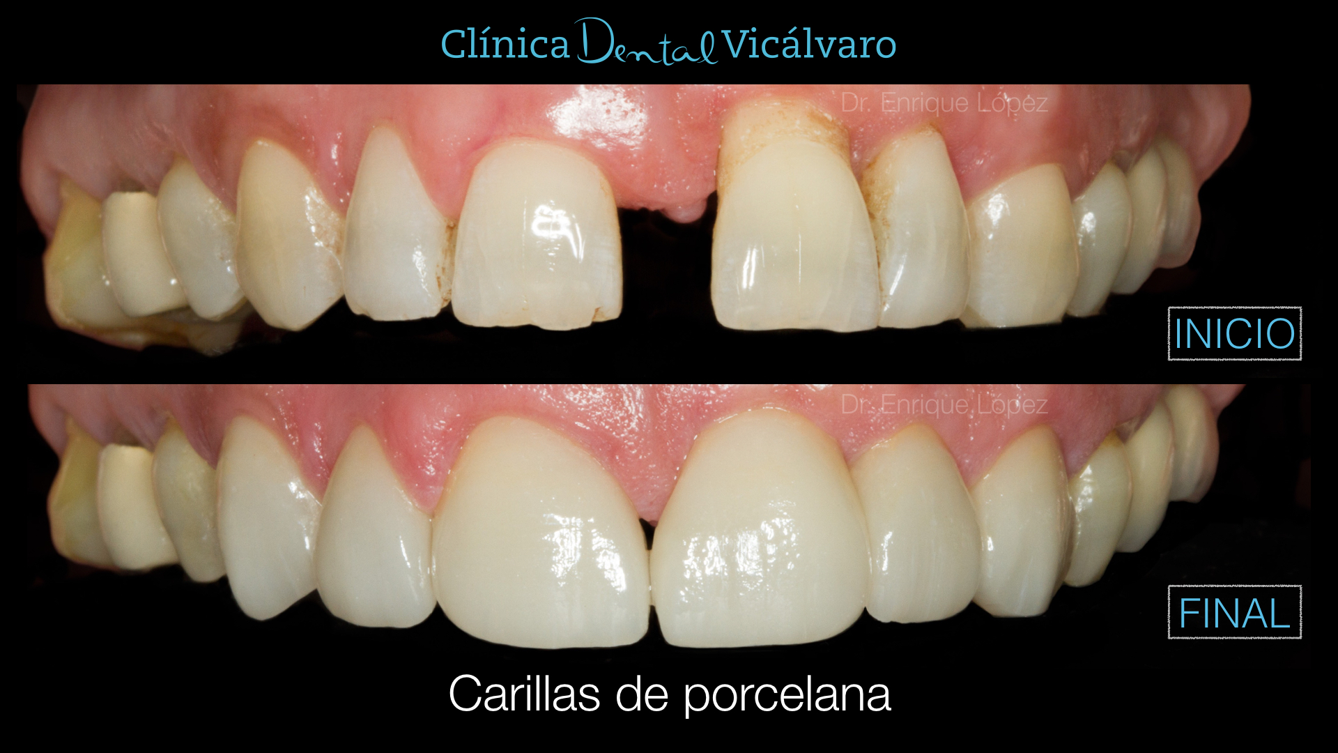 Foto comparativa 3