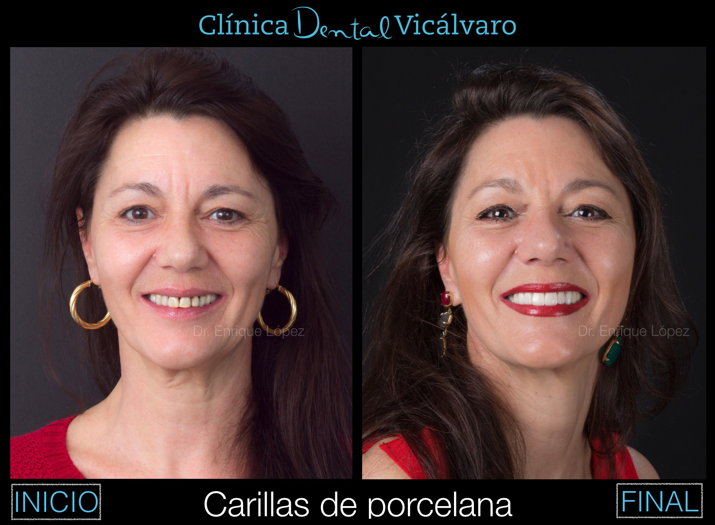 Foto comparativa 1