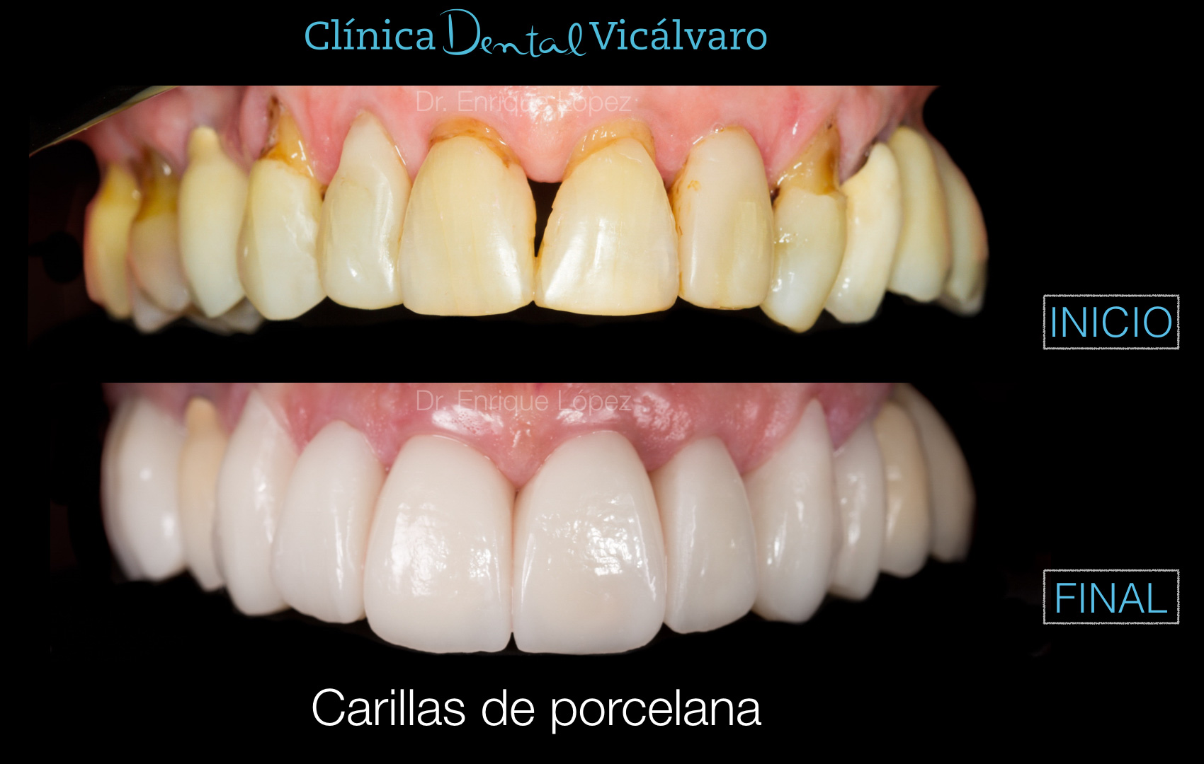 Foto comparativa 2