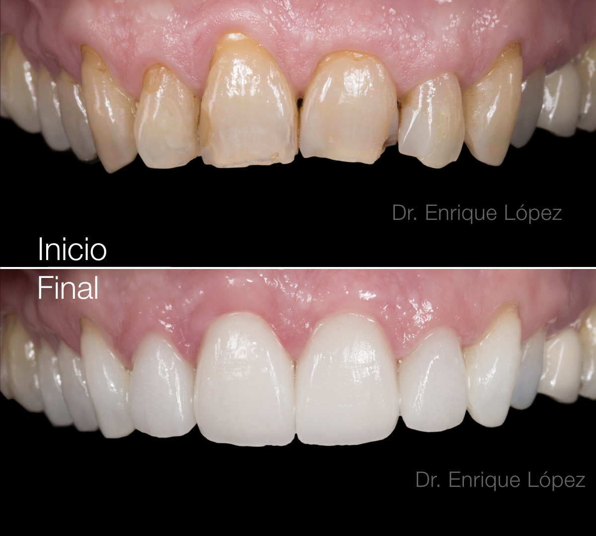 Foto comparativa 1