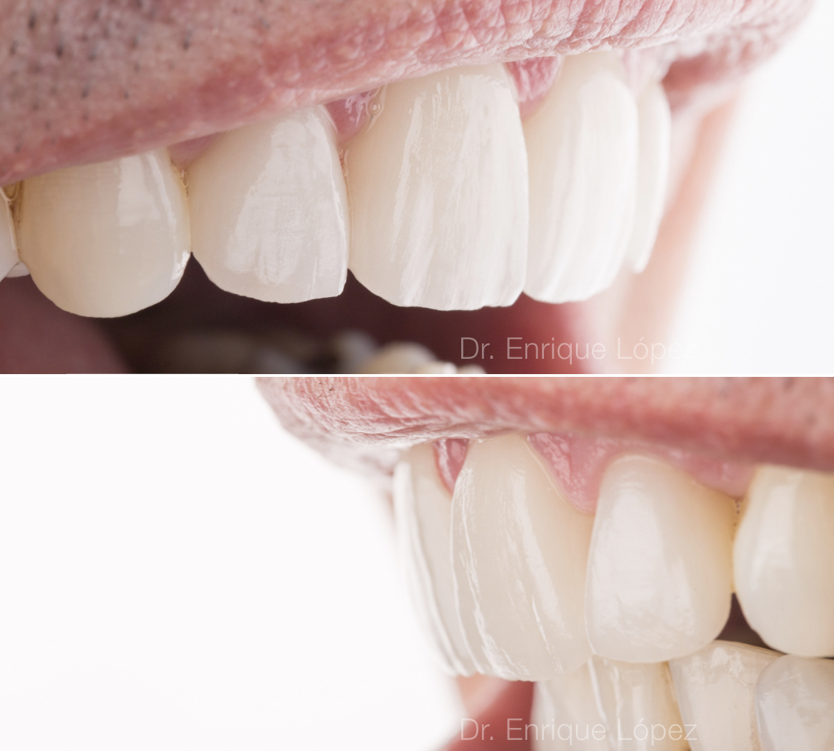 Foto comparativa 2