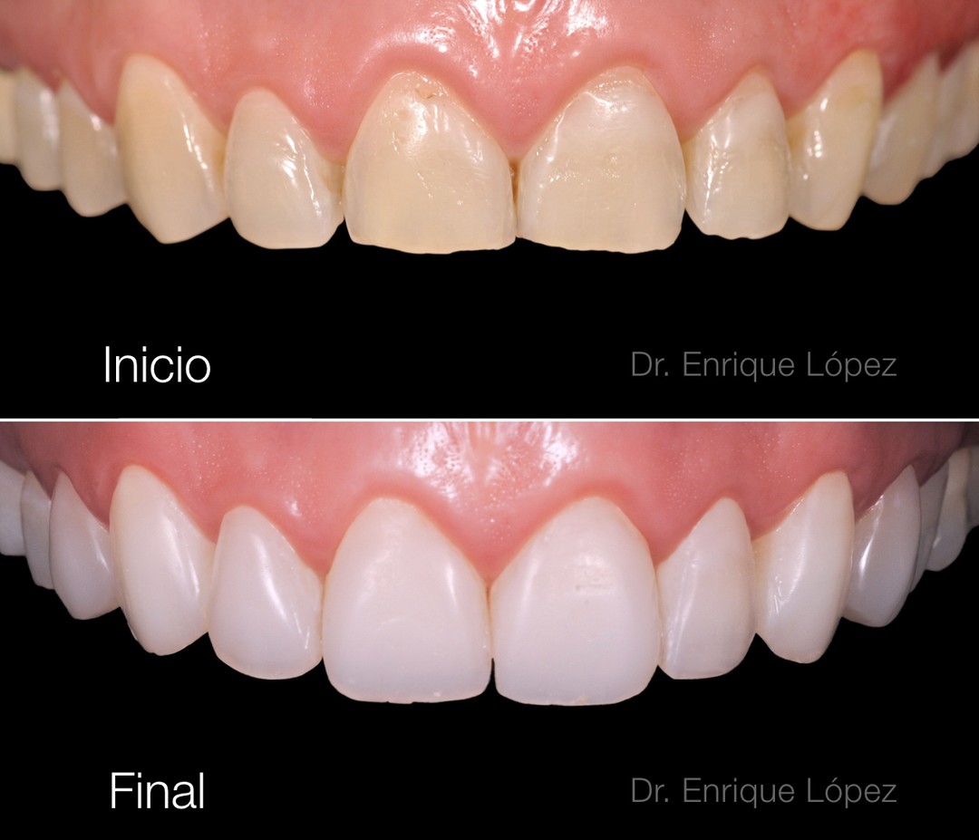 Foto comparativa 1