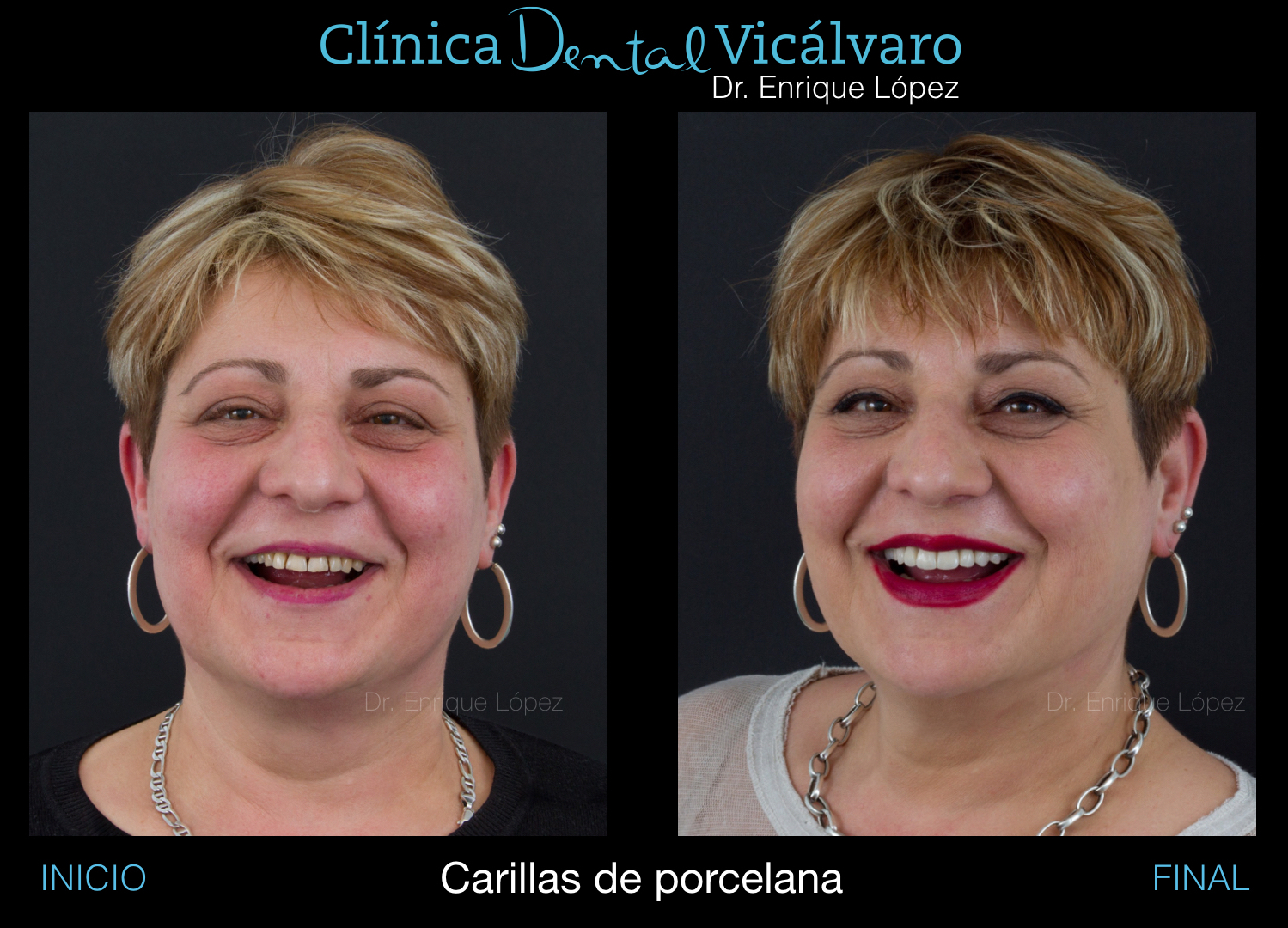 Foto comparativa 1
