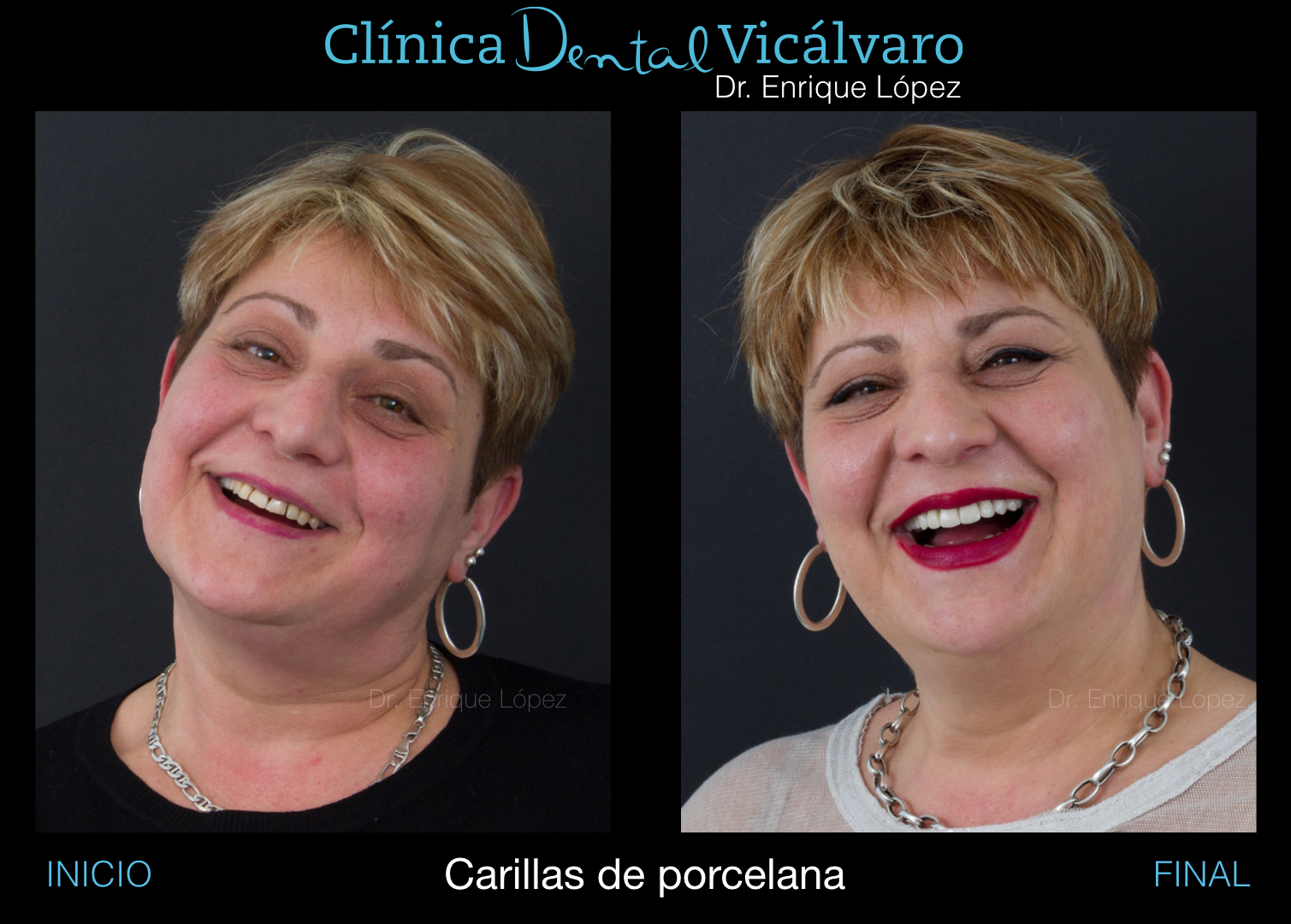 Foto comparativa 2