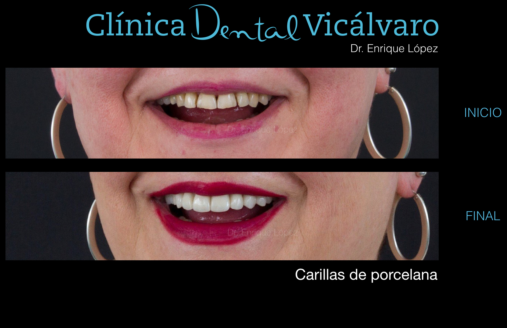 Foto comparativa 3