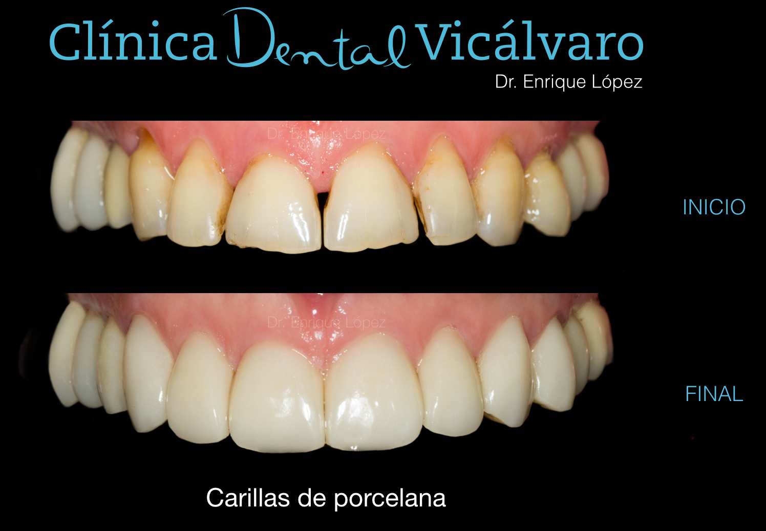 Foto comparativa 4