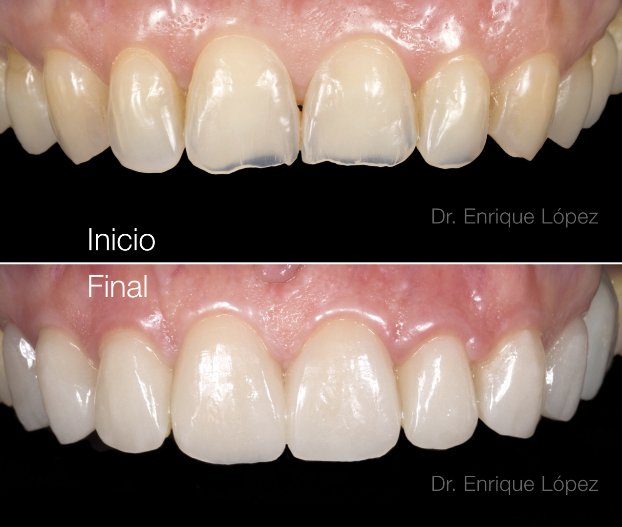 Foto comparativa 1