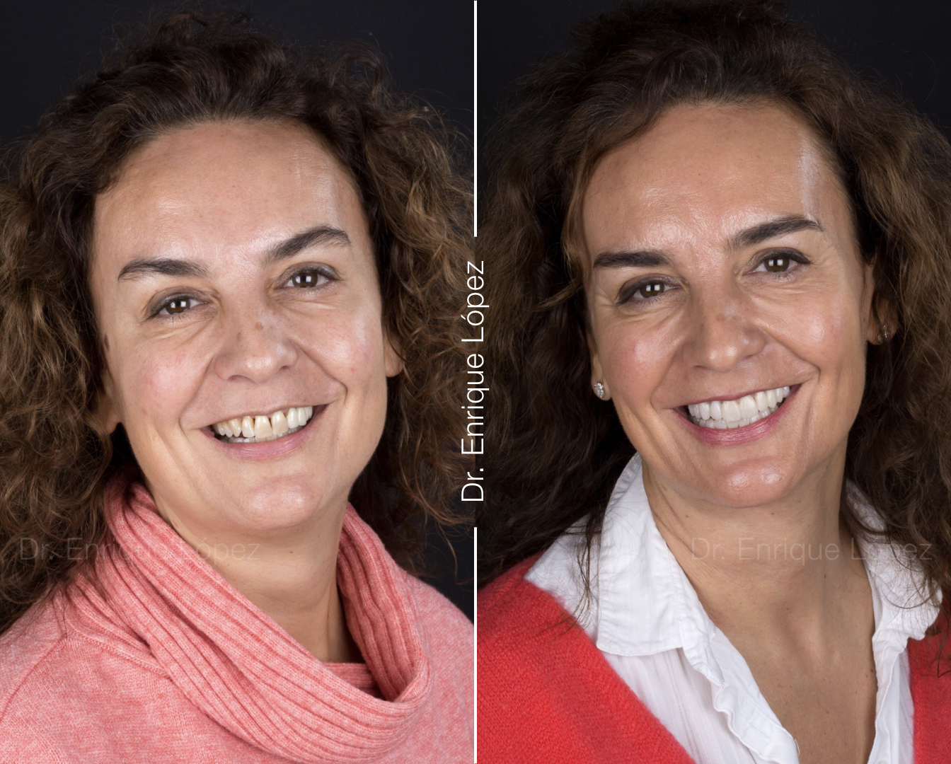 Foto comparativa 1