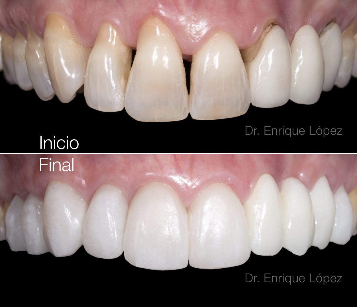 Foto comparativa 2