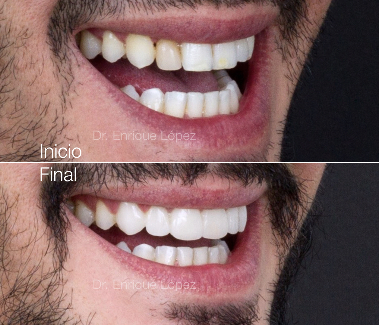 Foto comparativa 1