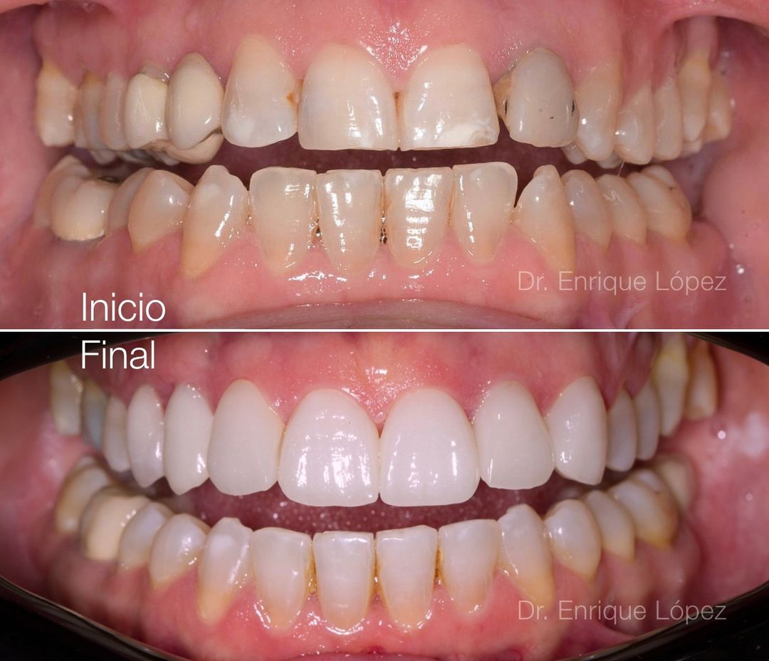 Foto comparativa 4