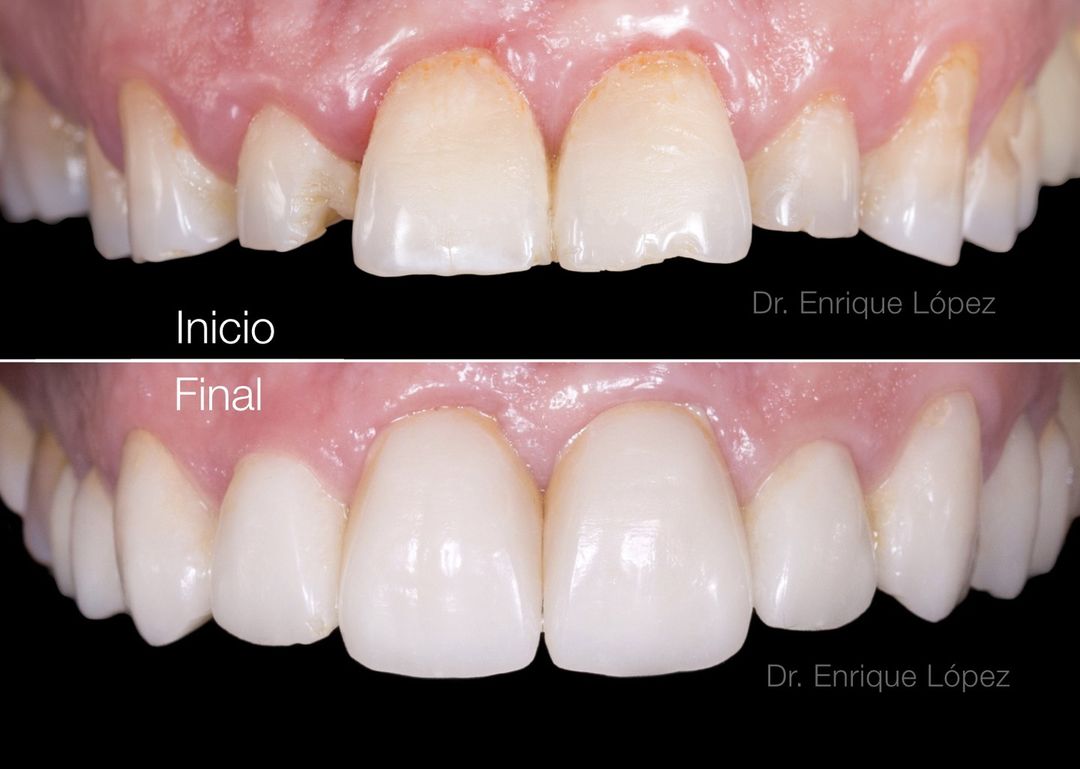 Foto comparativa 1