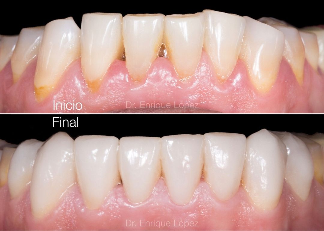 Foto comparativa 2