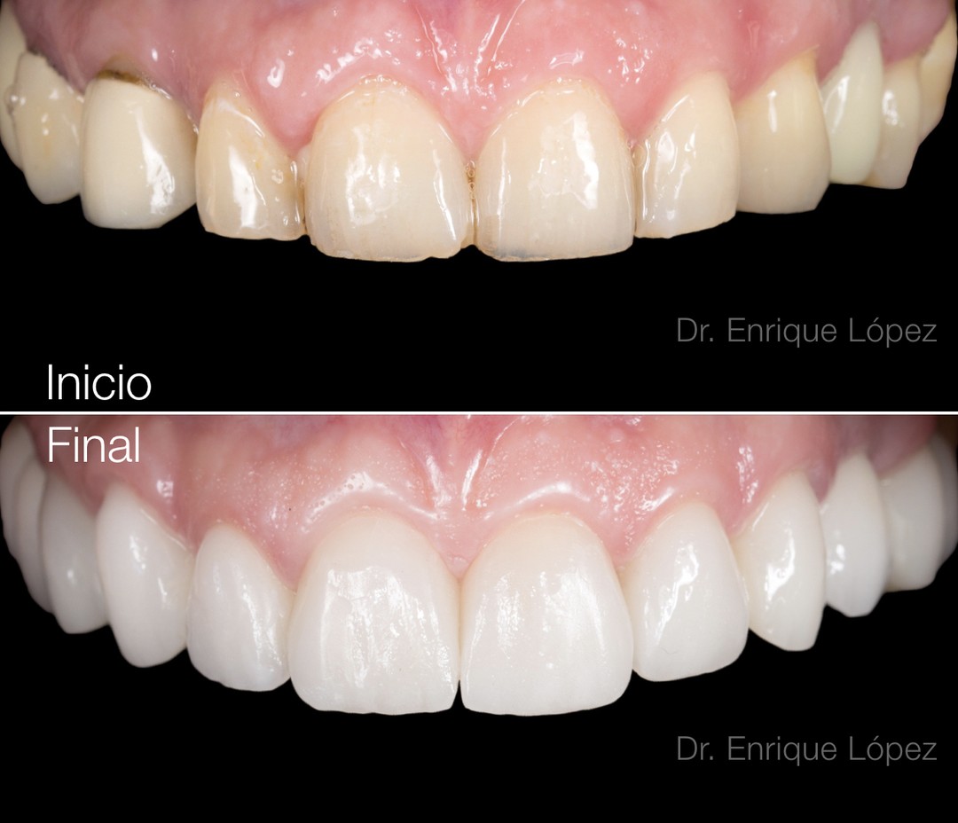 Foto comparativa 1
