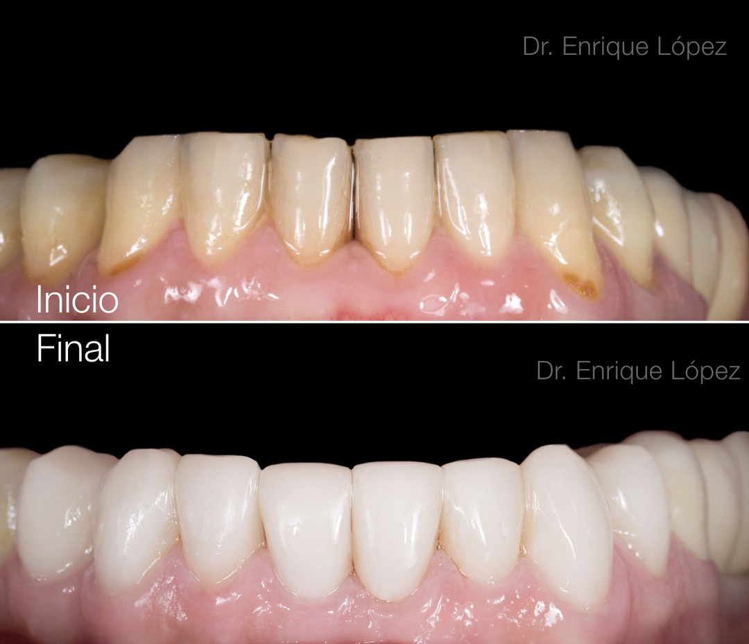 Foto comparativa 2