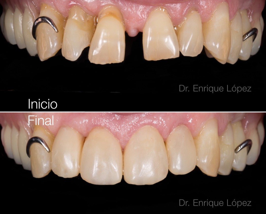 Foto comparativa 1