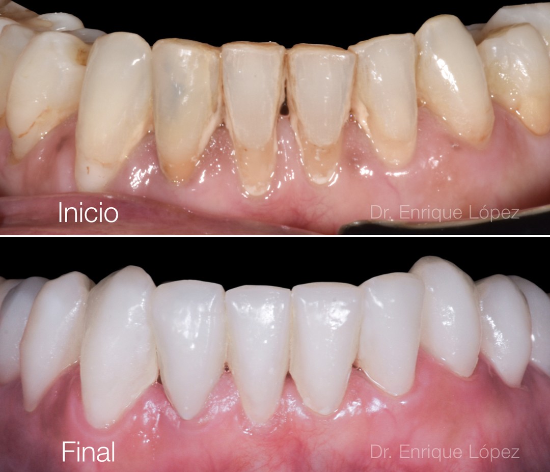 Foto comparativa 2