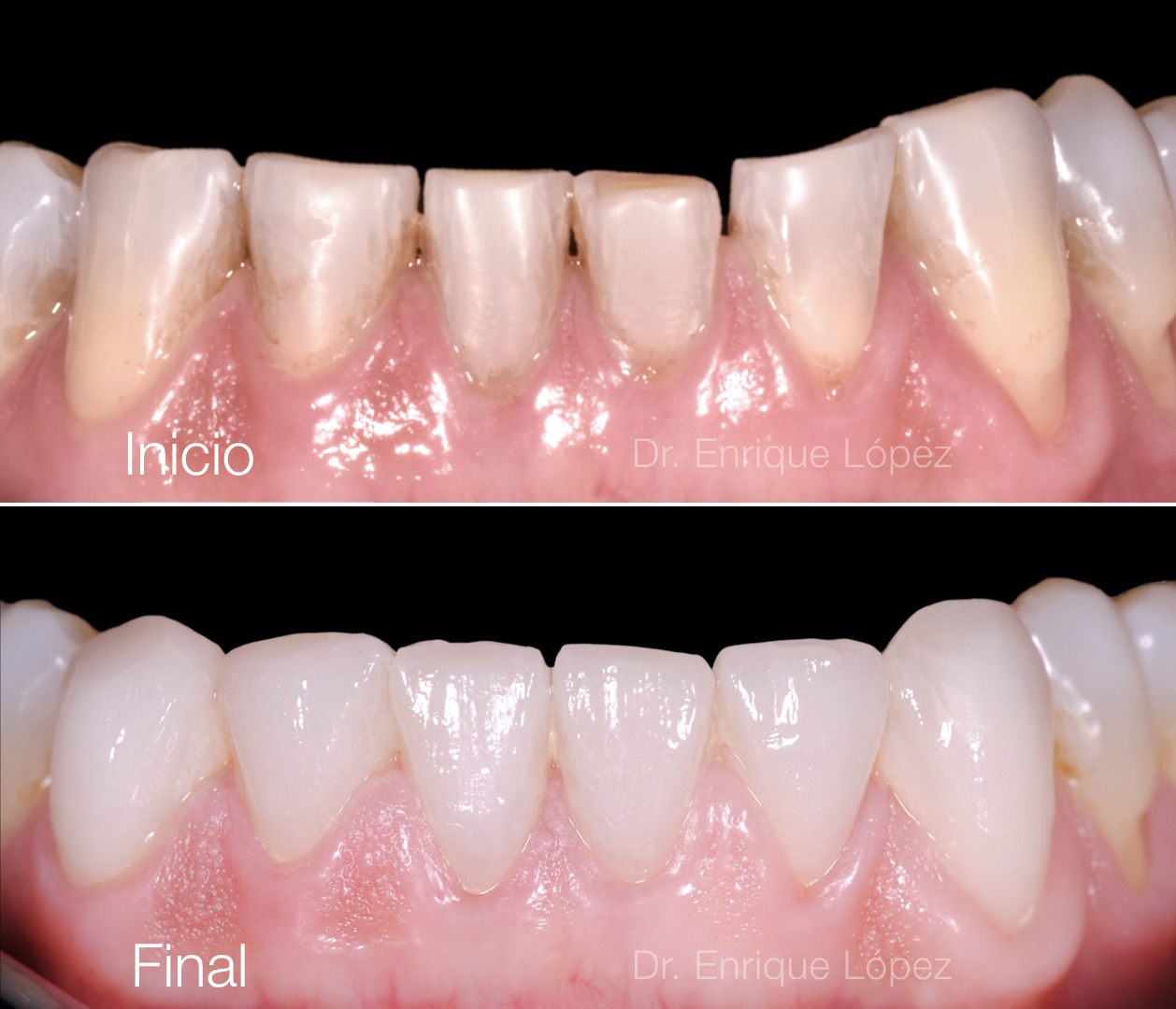 Foto comparativa 1