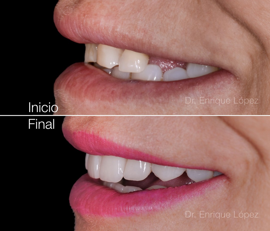 Foto comparativa 2