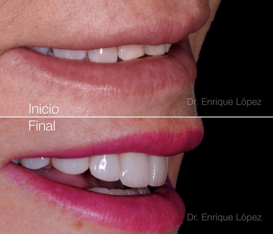 Foto comparativa 3