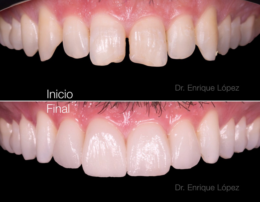 Foto comparativa 1