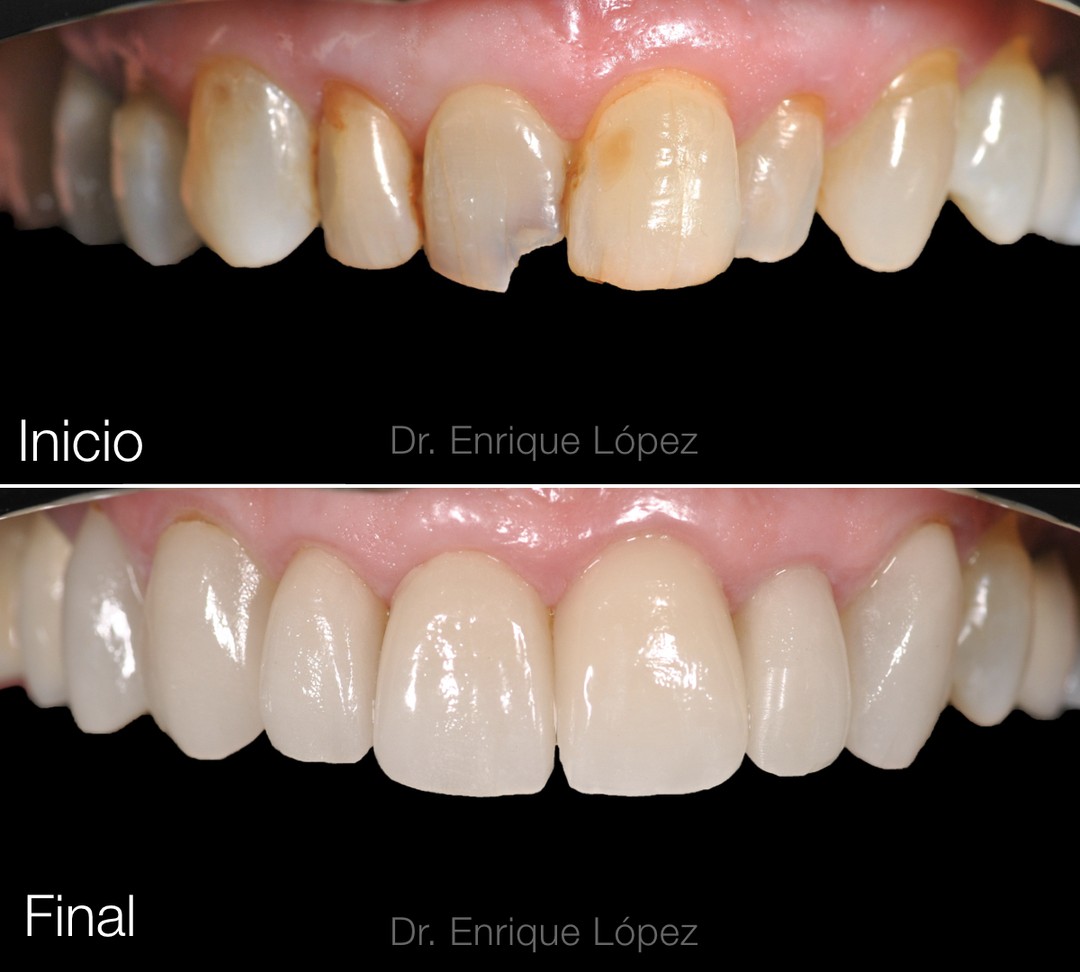 Foto comparativa 1