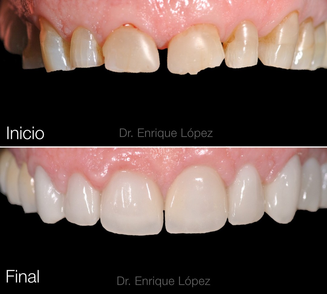 Foto comparativa 1