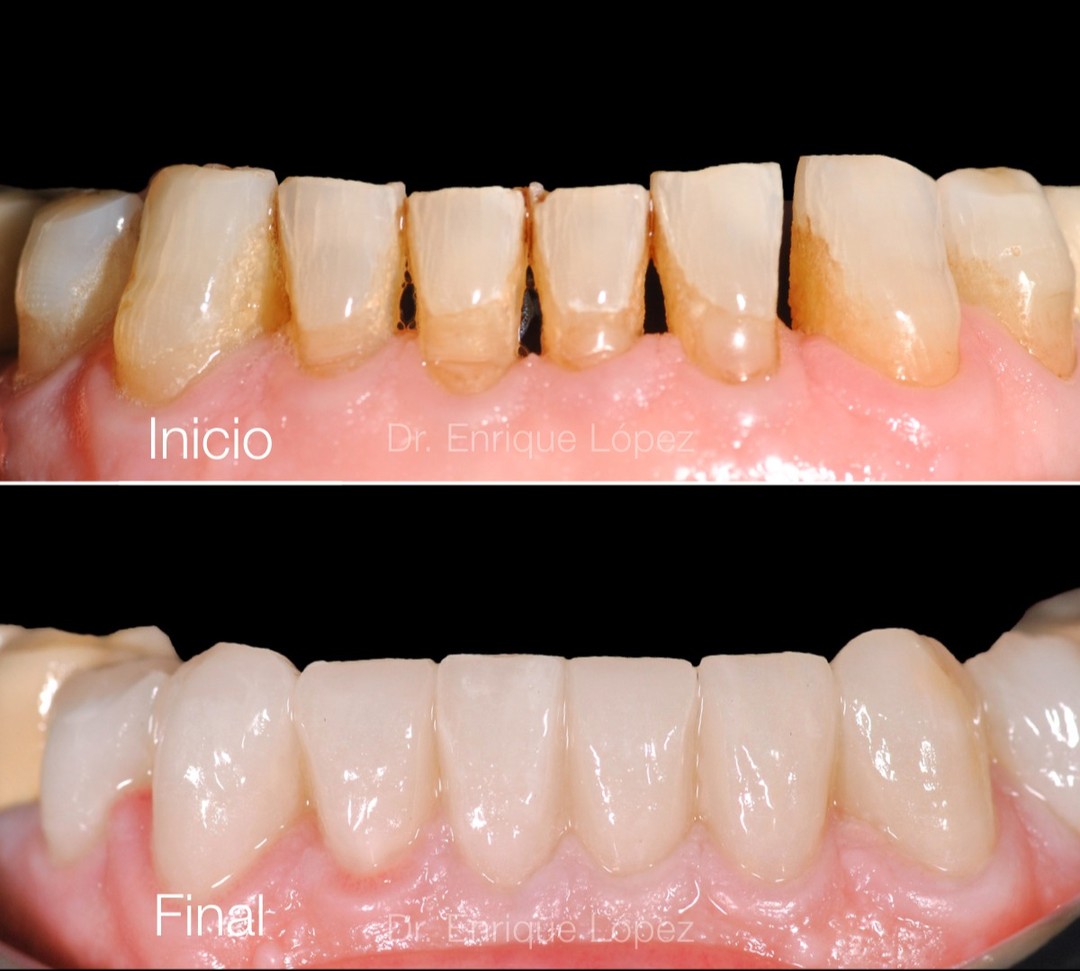 Foto comparativa 2