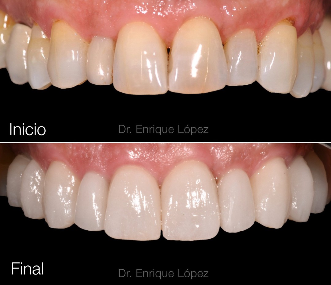 Foto comparativa 1