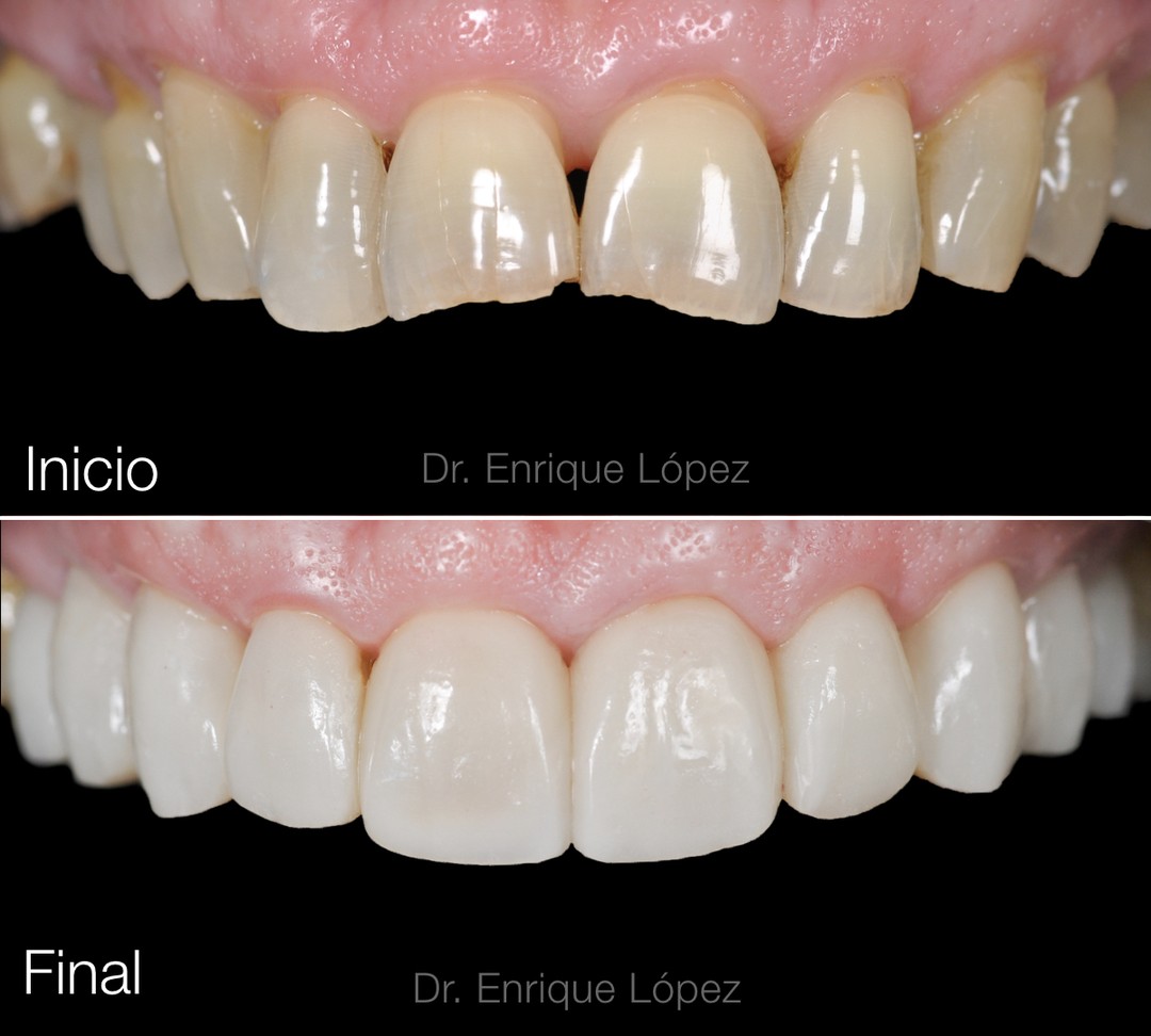 Foto comparativa 1