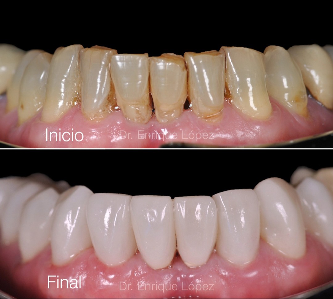 Foto comparativa 2