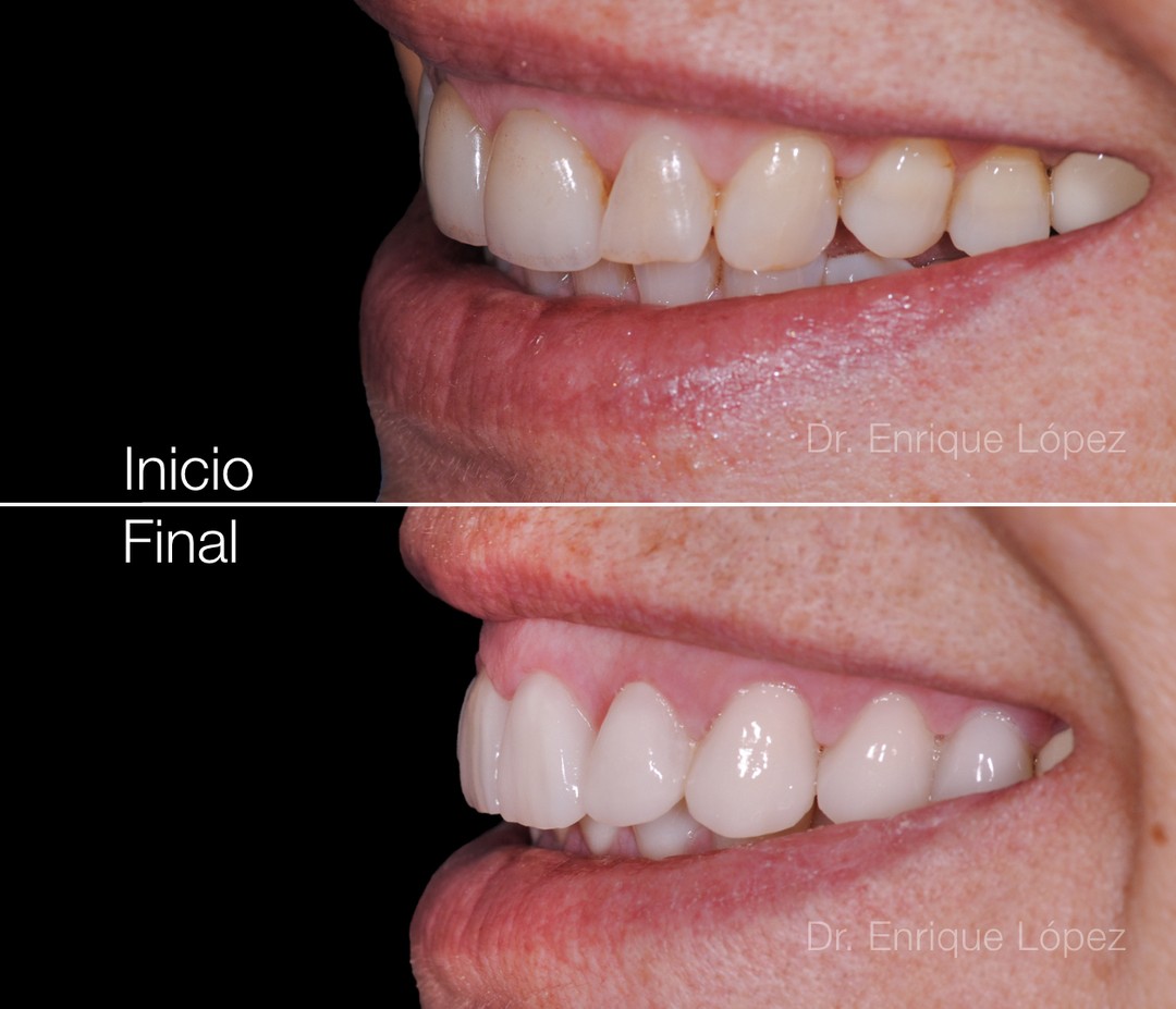 Foto comparativa 1