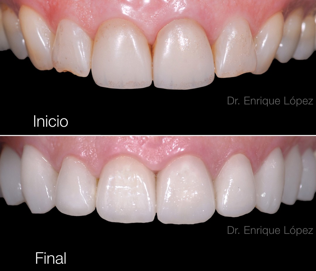 Foto comparativa 2
