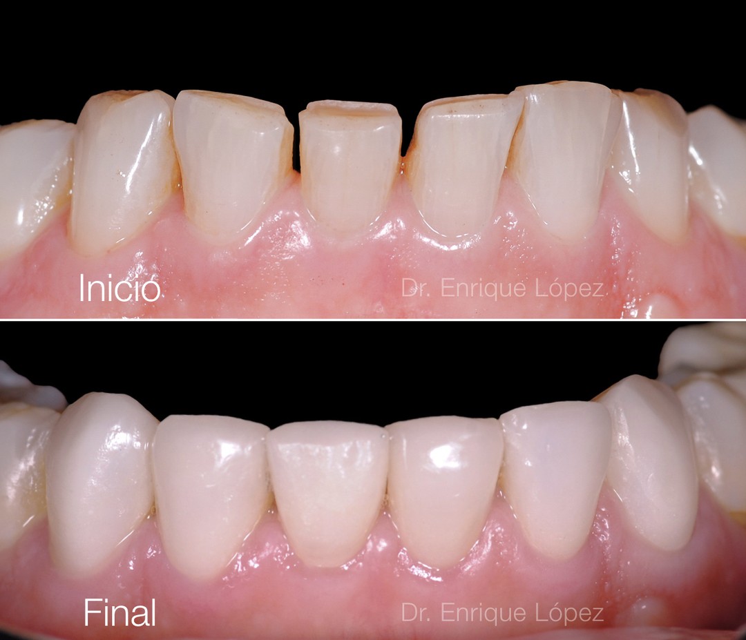 Foto comparativa 3