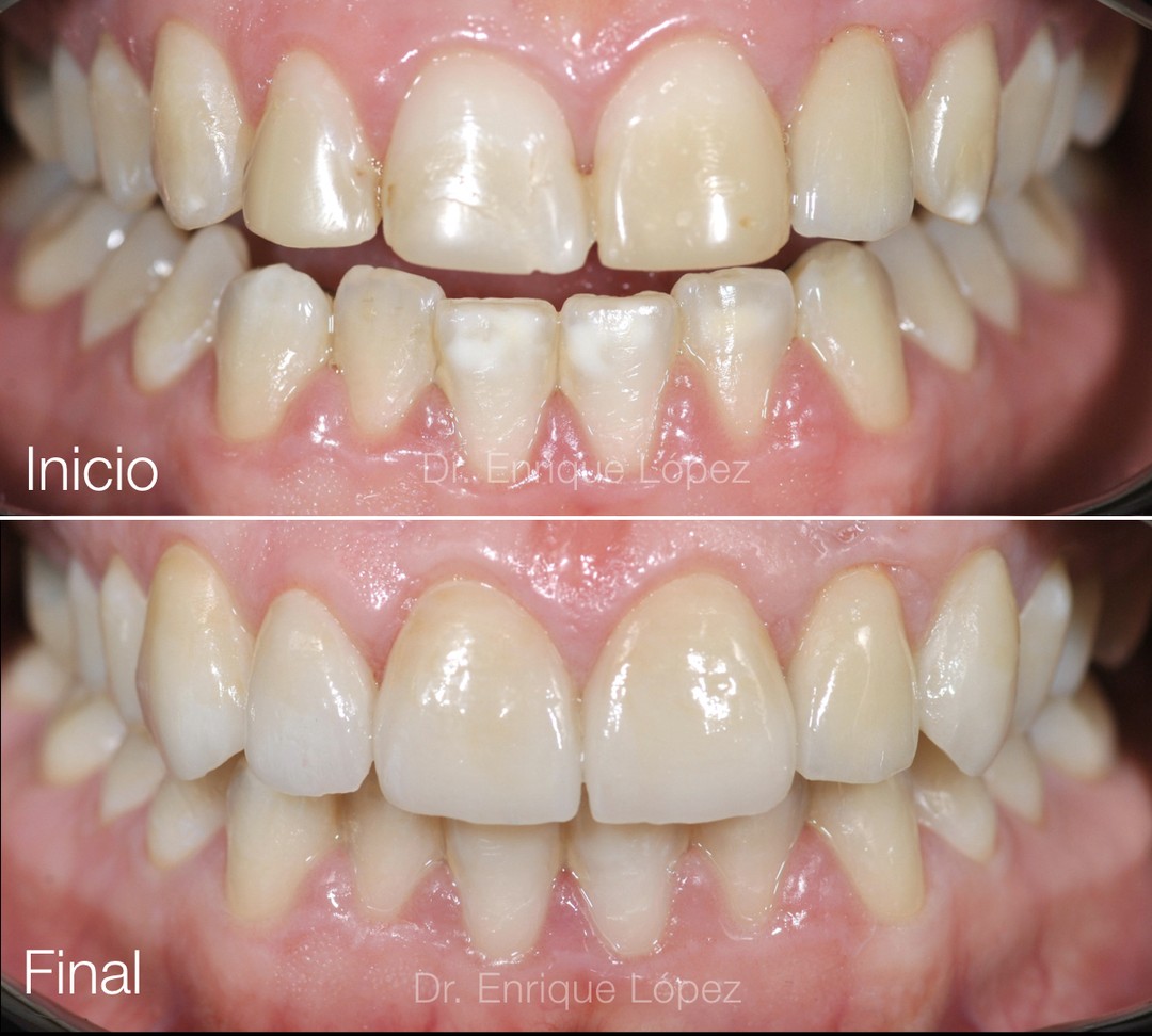Foto comparativa 1