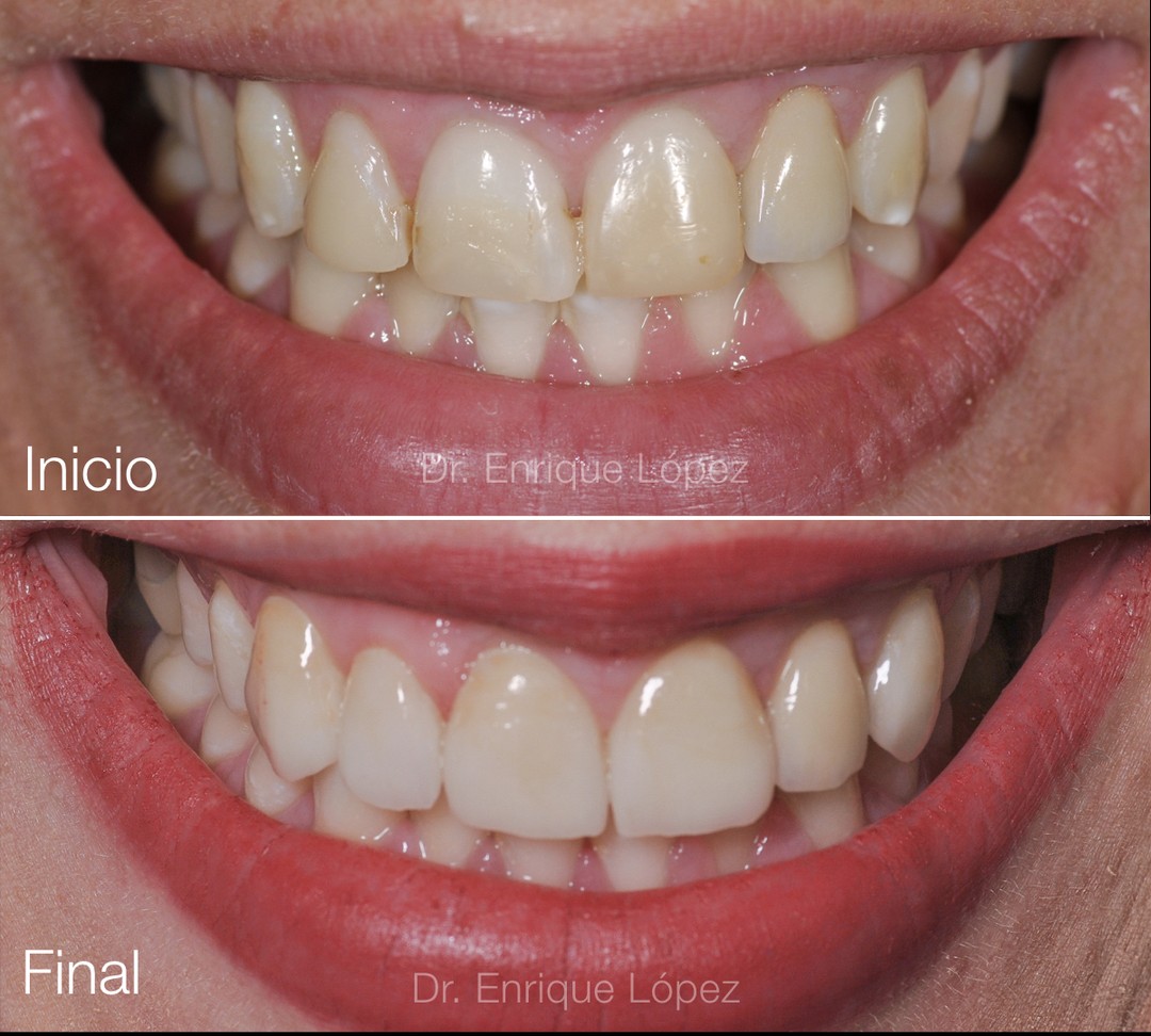 Foto comparativa 2