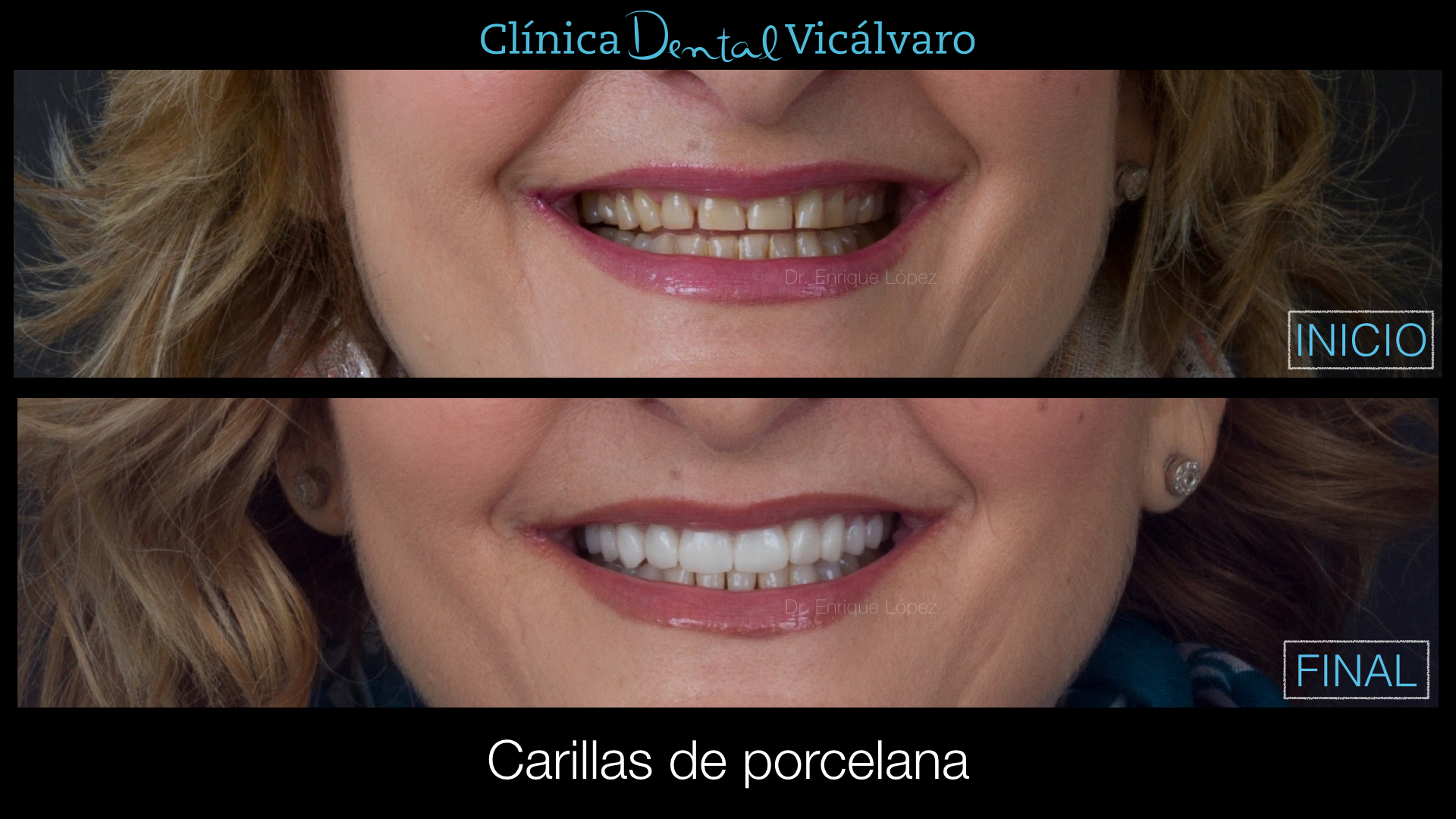 Foto comparativa 1