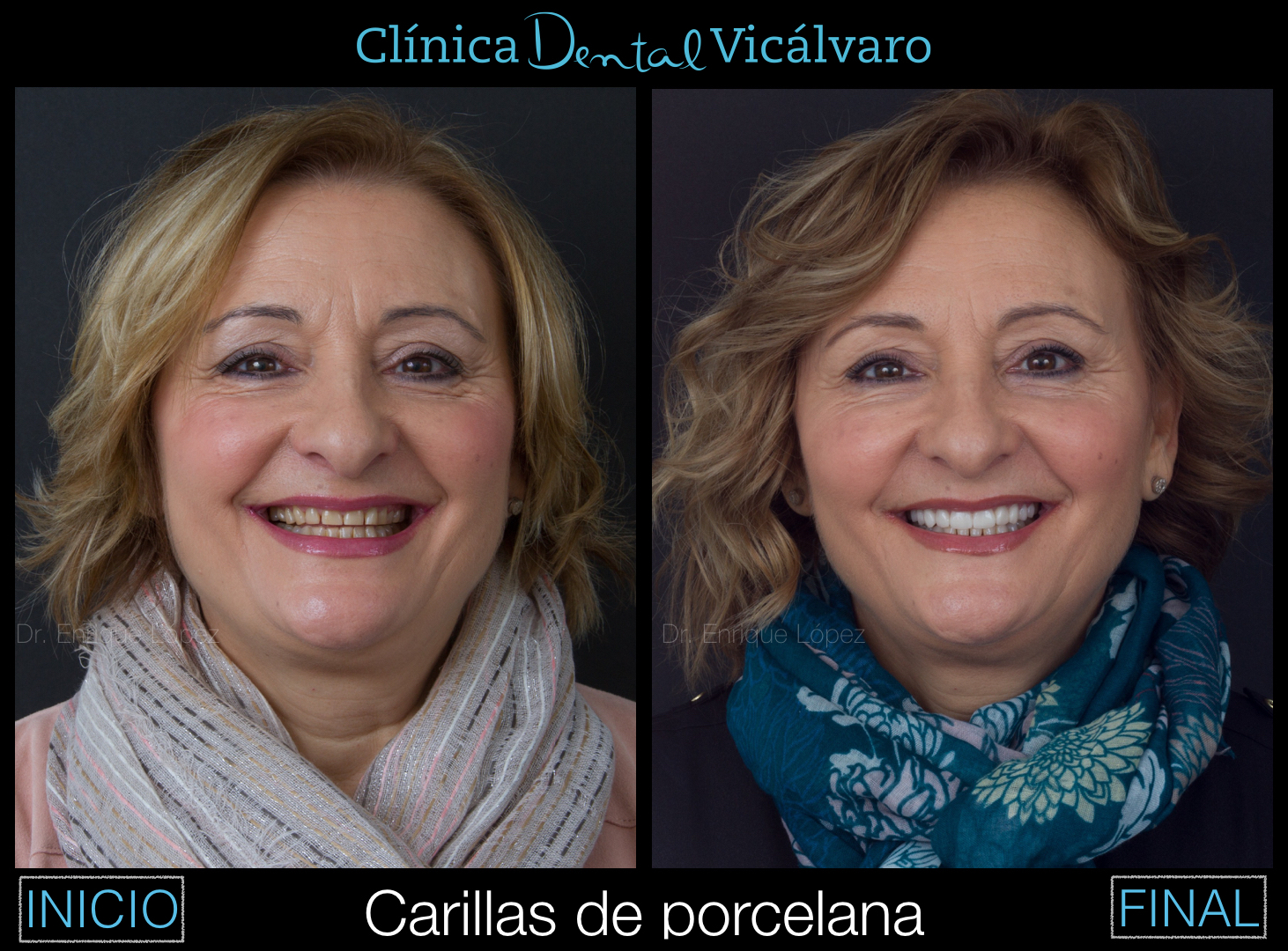 Foto comparativa 2