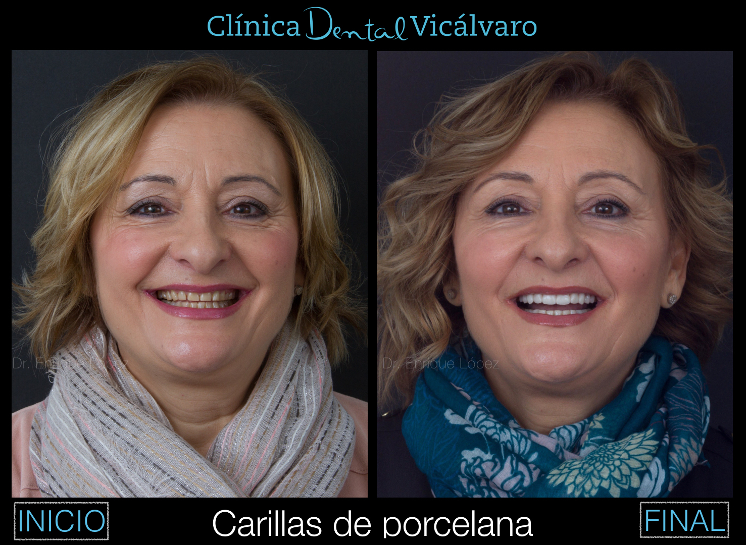 Foto comparativa 3
