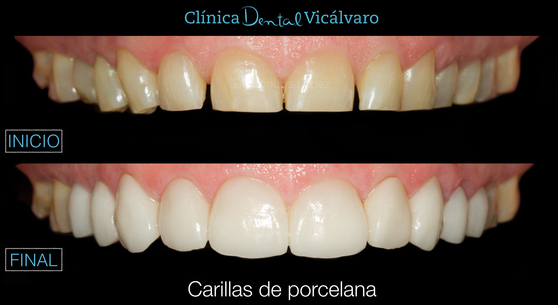 Foto comparativa 4
