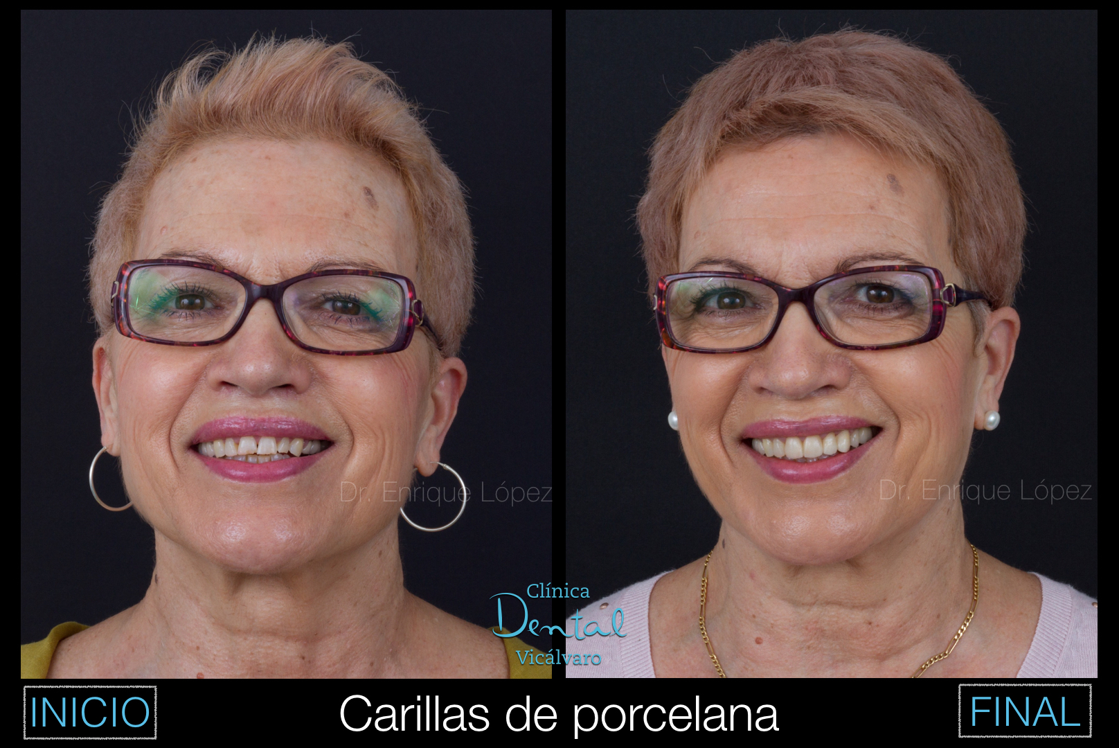 Foto comparativa 1