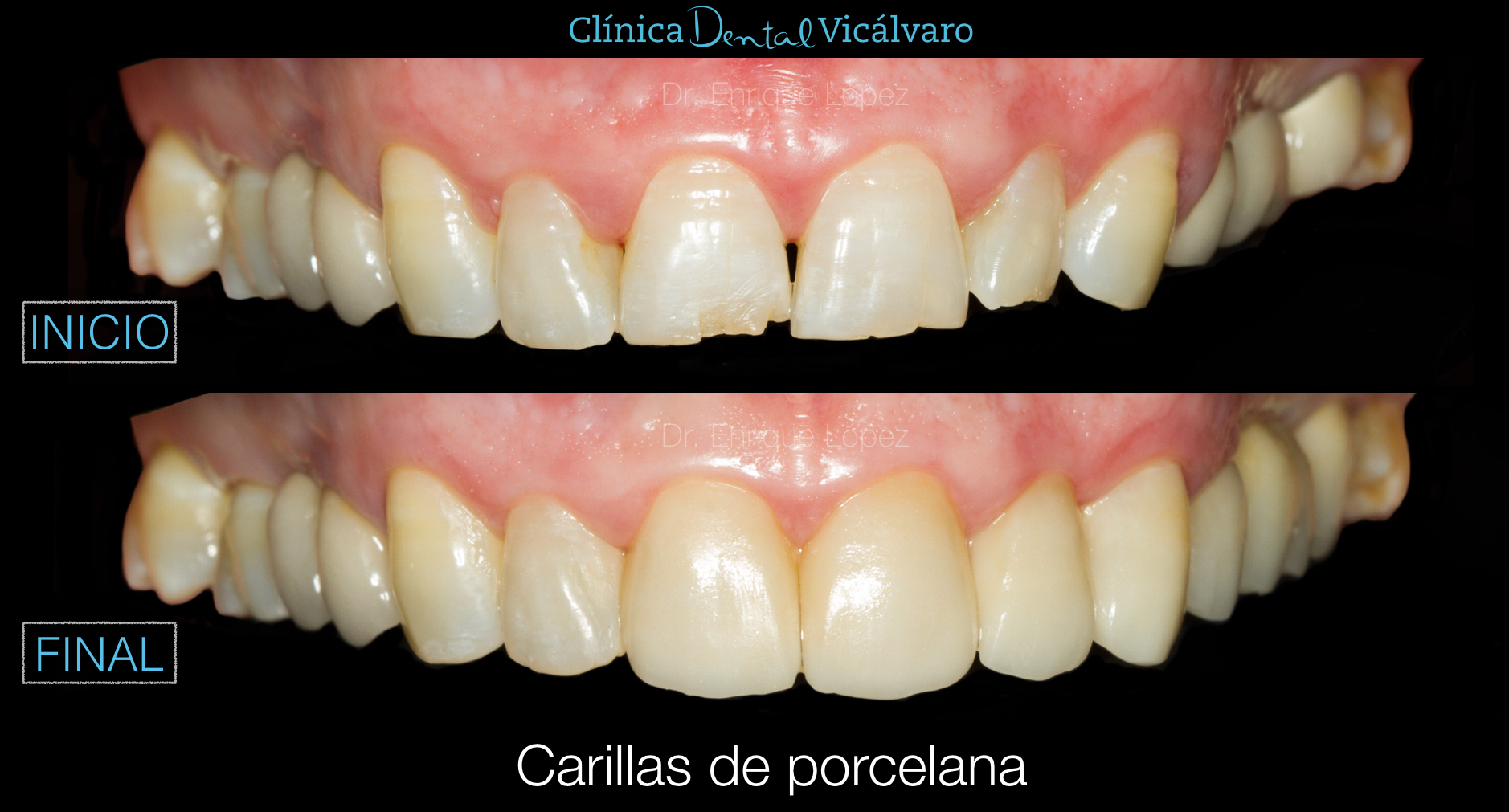 Foto comparativa 4