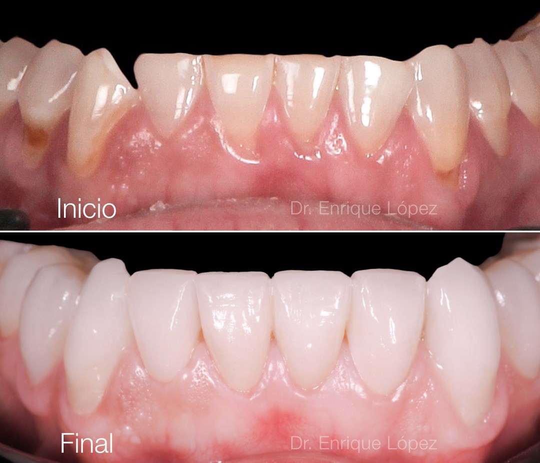 Foto comparativa 2