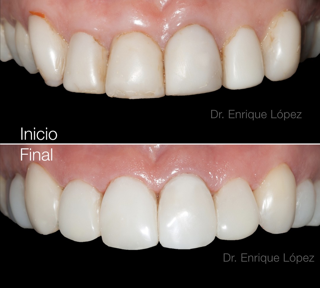 Foto comparativa 1