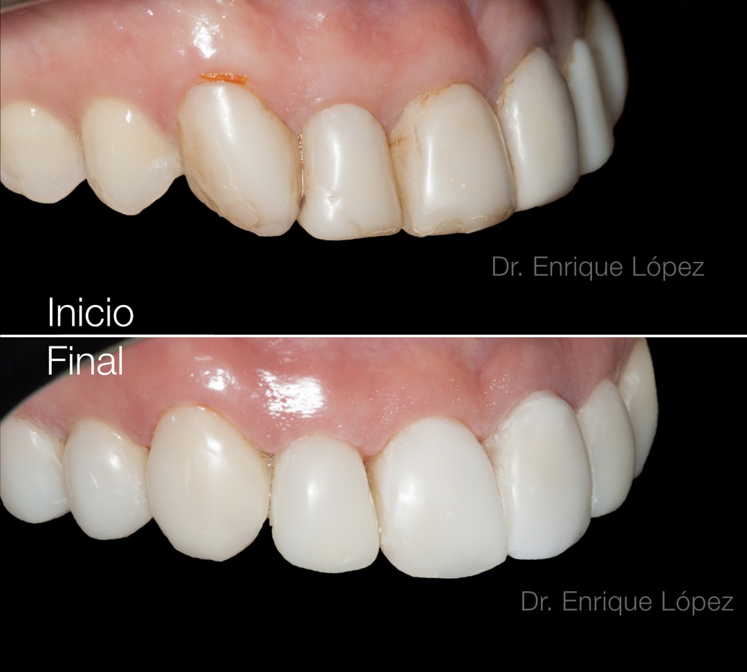Foto comparativa 2