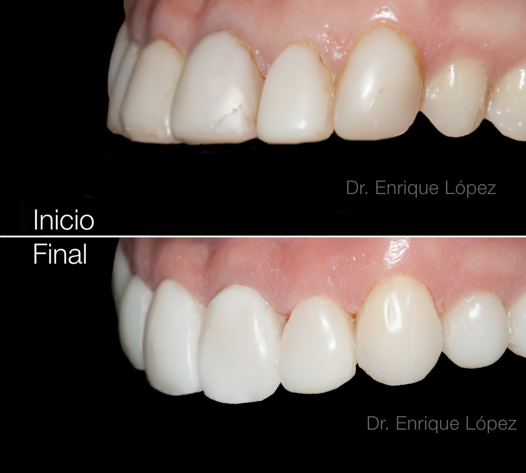 Foto comparativa 3