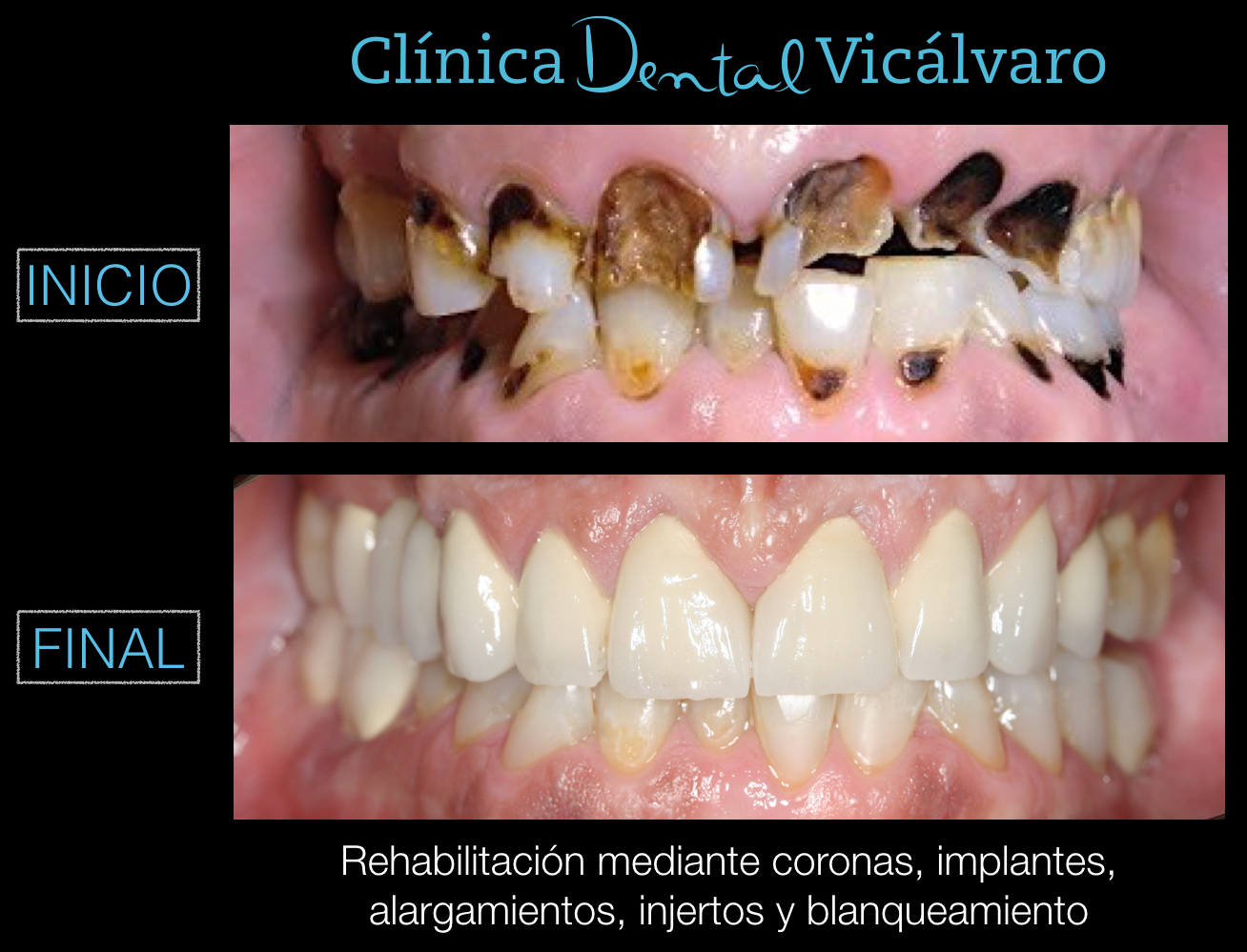 Imagen del caso "4"